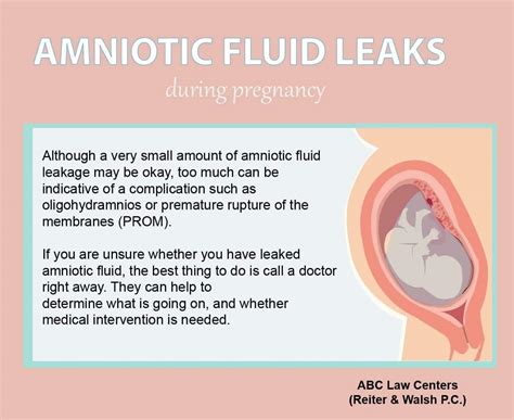 leakage of amniotic fluid|Leaking Amniotic Fluid: Signs, Causes, and。